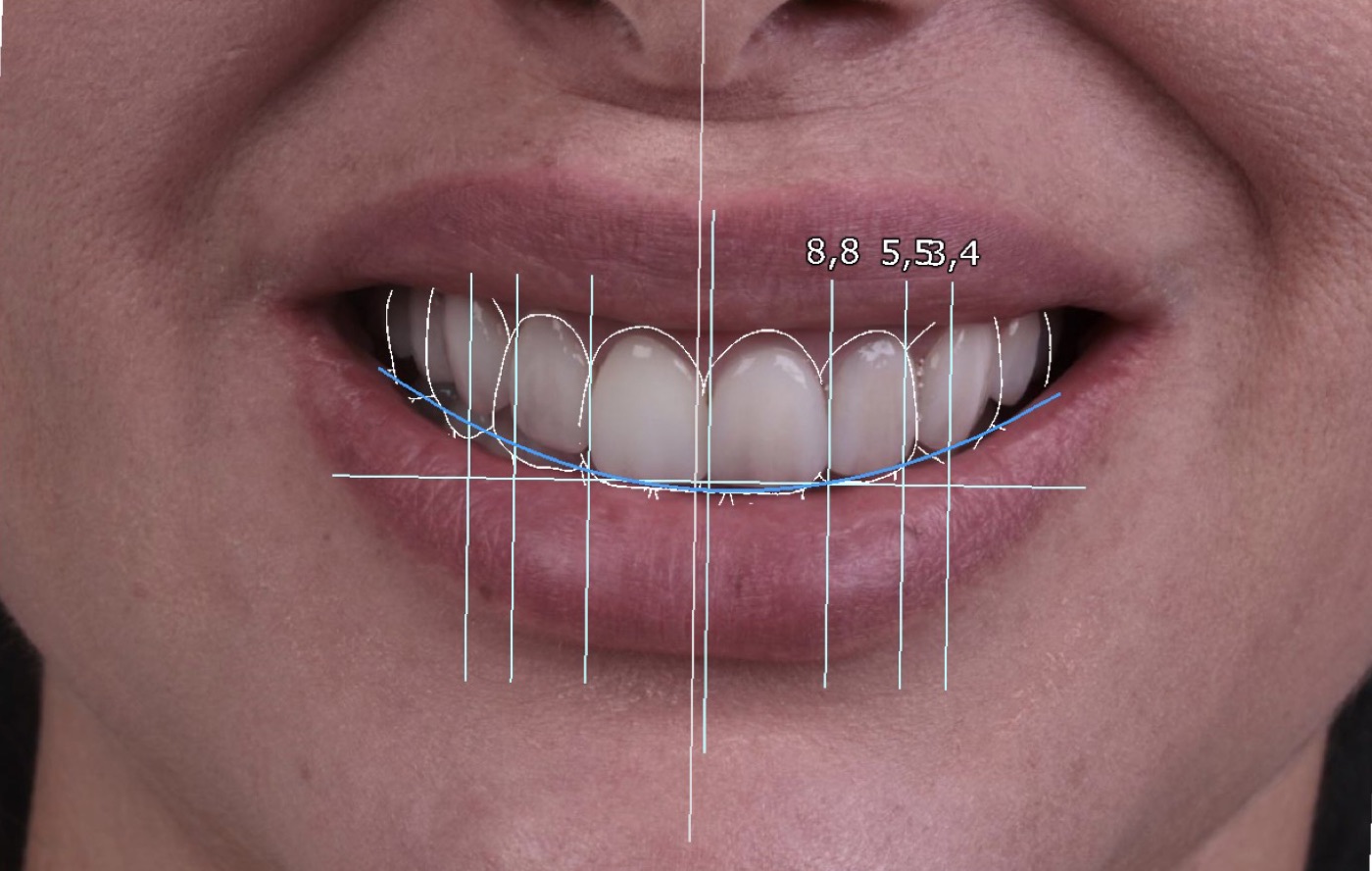 Análise das proporções faciais